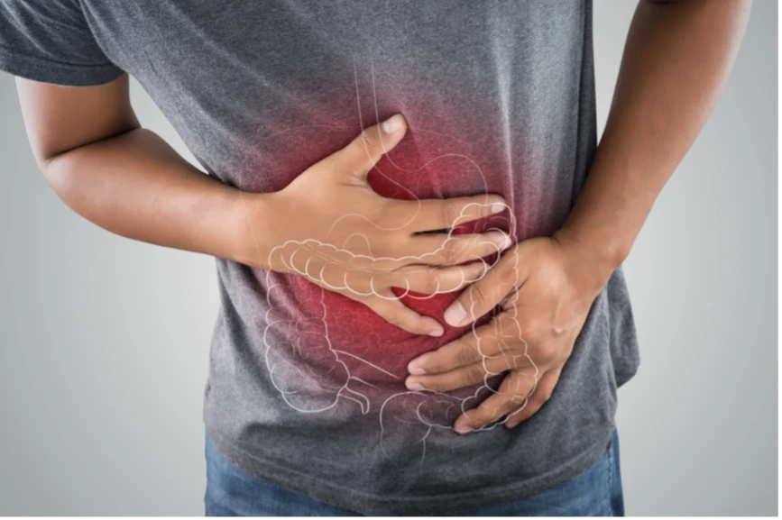 Đau bụng dữ dội là dấu hiệu hội chứng ruột kích thích
